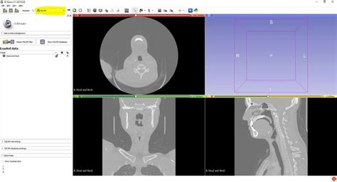 nrrd to stl|nrrd to dicom.